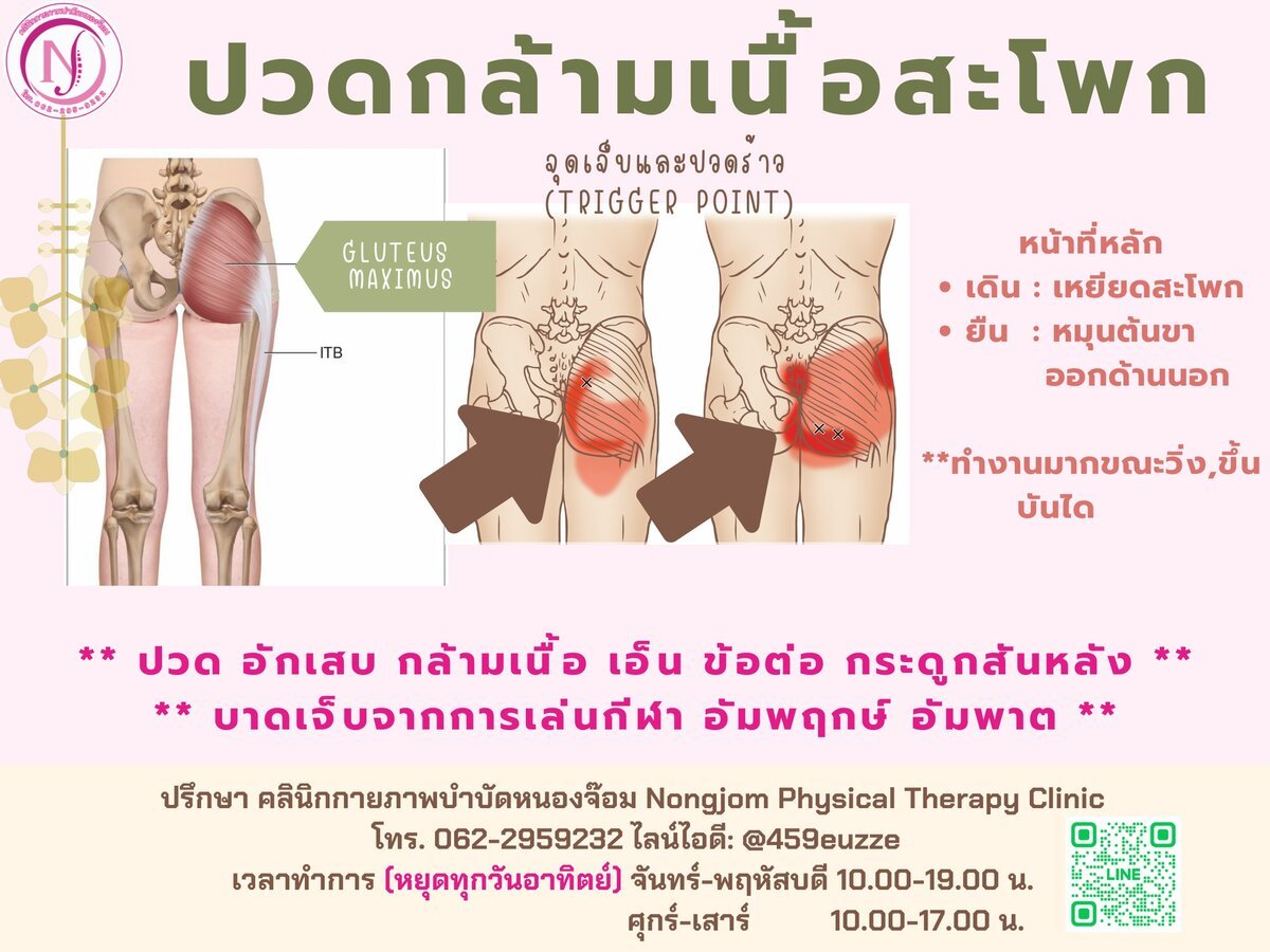 จุดปวดร้าว Gluteus Maximus