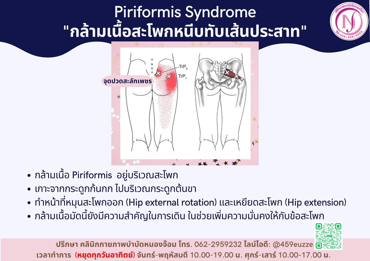 จุดปวดสะลักเพชร Piriformis
