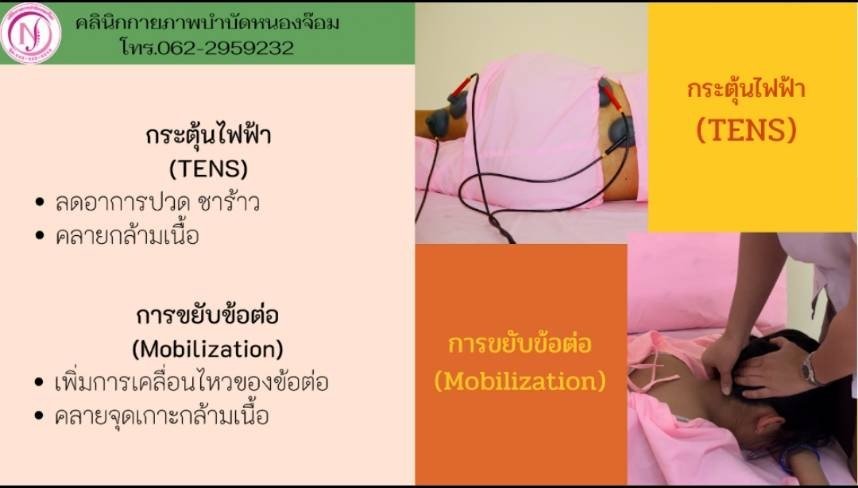 TENS และ Mobilization